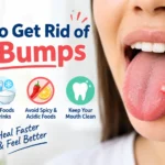 how to get rid of lie bumps